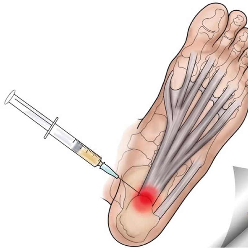 Neoprene Ayak Bileği Bağı Universal 2